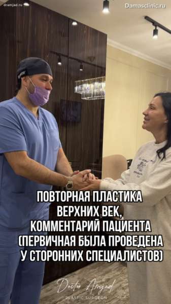 Повторная пластика верхних век, комментарий пациента (первичная была проведена у сторонних специалистов)