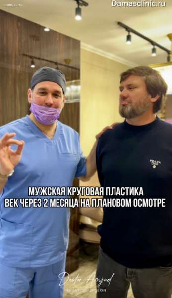 Верхняя и нижняя мужская пластика век. Видео-результат с отзывом пациента на плановом осмотре
