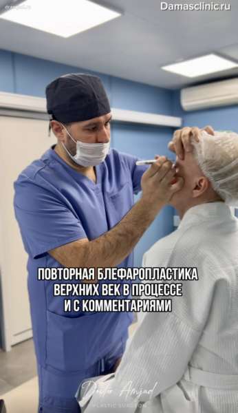 Повторная блефаропластика верхних век в процессе и с комментариями в видео