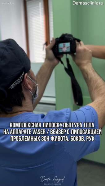 Комплексная липоскульптура тела на аппарате VASER / ВЕЙЗЕР с липосакцией проблемных зон живота, боков, рук с видео и фото сразу после