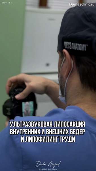 Ультразвуковая липосакция внутренних и внешних бедер и липофилинг груди. Видео и фото результатов