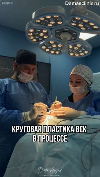 Как лучше проводить верхнюю и нижнюю пластику век: поэтапно или одномоментно?