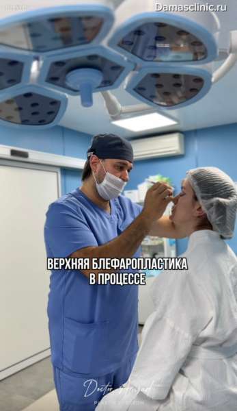 Верхняя блефаропластика в процессе. Виды верхней блефаропластики и показания (с фото-результатами)